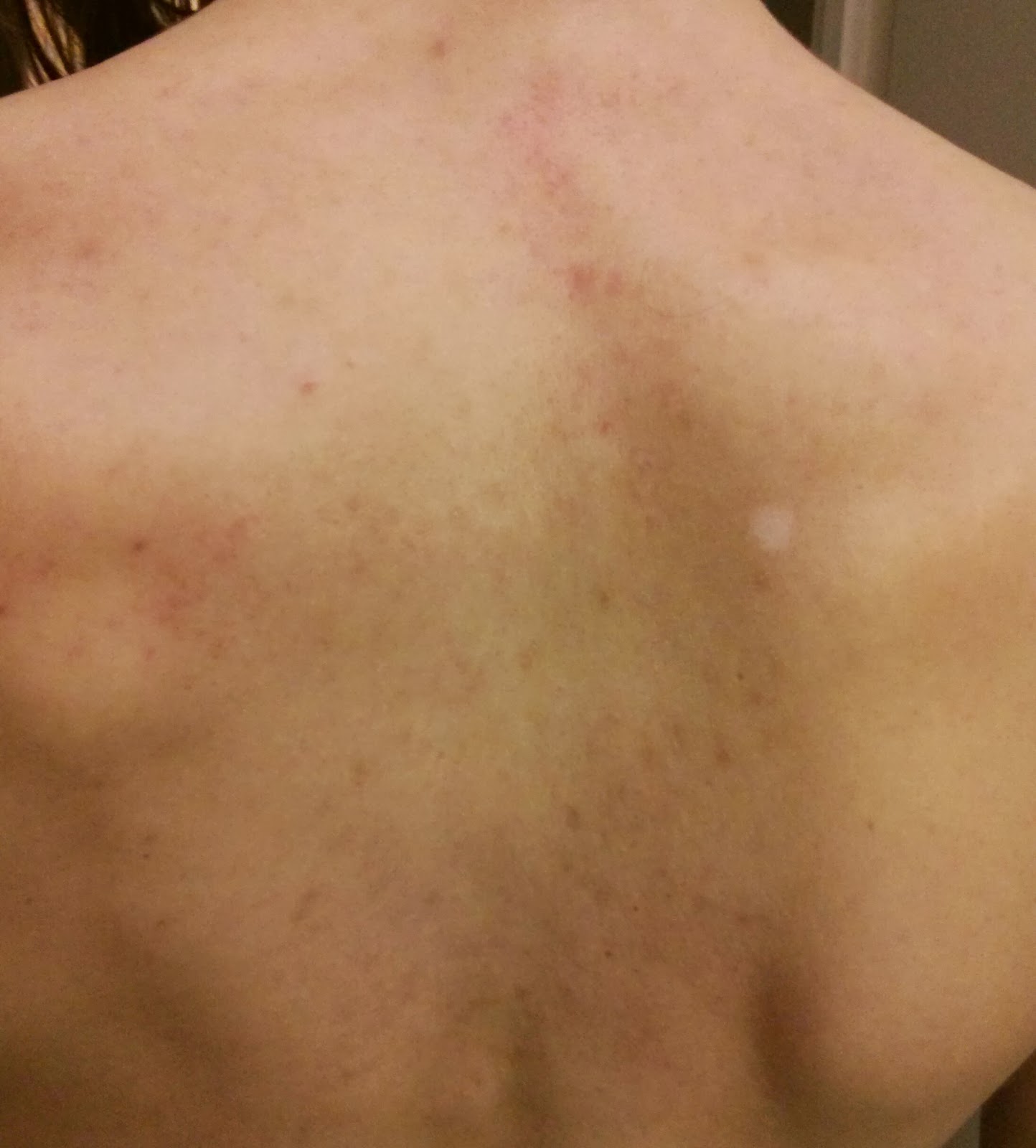 Que traite de la douleur plus bas reins