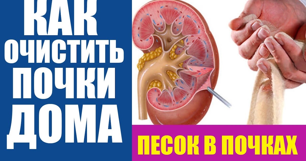 Как почистить почки в домашних Как почистить почки в домашних