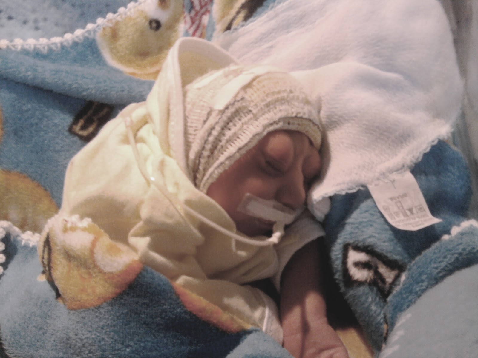 Anencephaly+Stories also pray that, hearing about Fabio Gabriel´s story, many other ...
