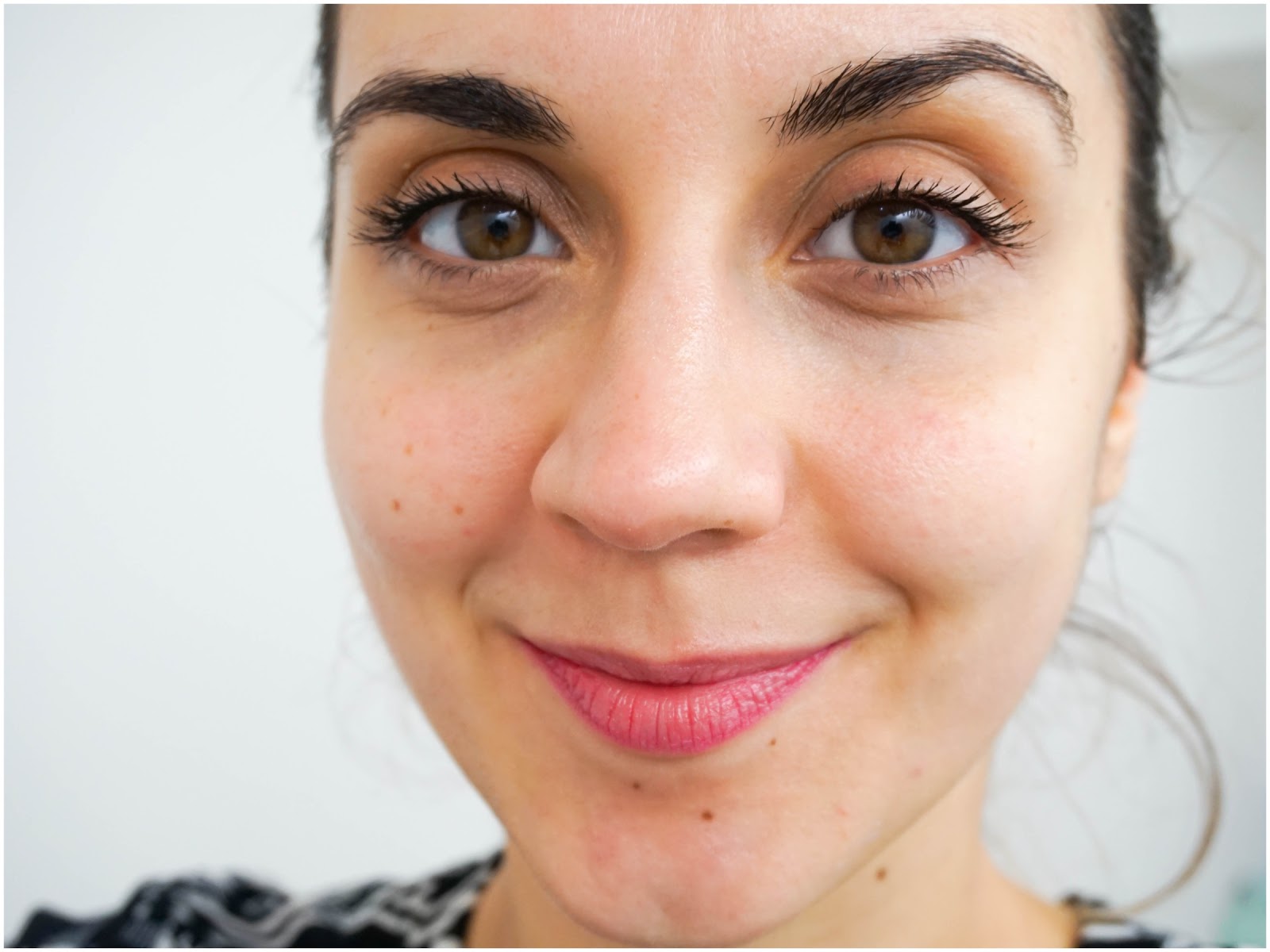 A Skincare Treat With Premier Laser & Skin Clinic A Skincare Treat With Premier Laser & Skin Clinic