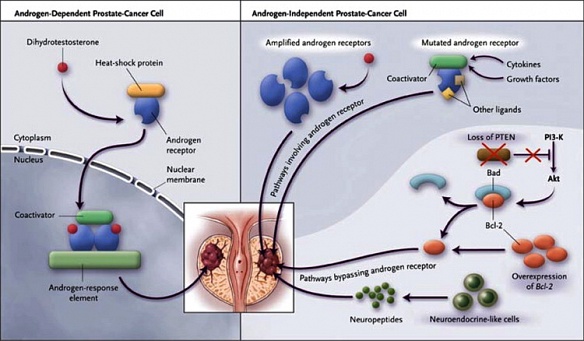 SEARCH AND BUY THIS PRODUCT MEDICAL ISSUE: PROSTATE CANCER: September 2012