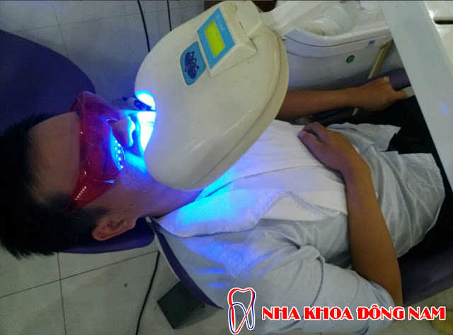 tẩy trắng răng sử dụng ánh sáng lạnh tẩy trắng răng sử dụng ánh sáng lạnh