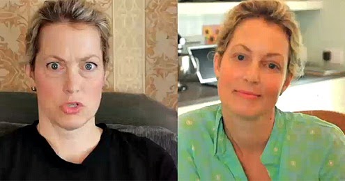 Star Plastic Surgery Star Comestic Surgery Ali Wentworth Plastic Surgery Before And After Facelift Photos