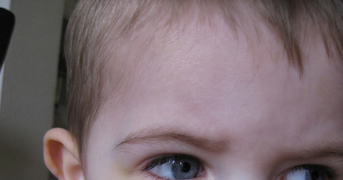 Gideon's Travels First Black Eye