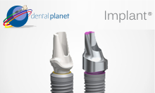 IMPLANTES DENTALES