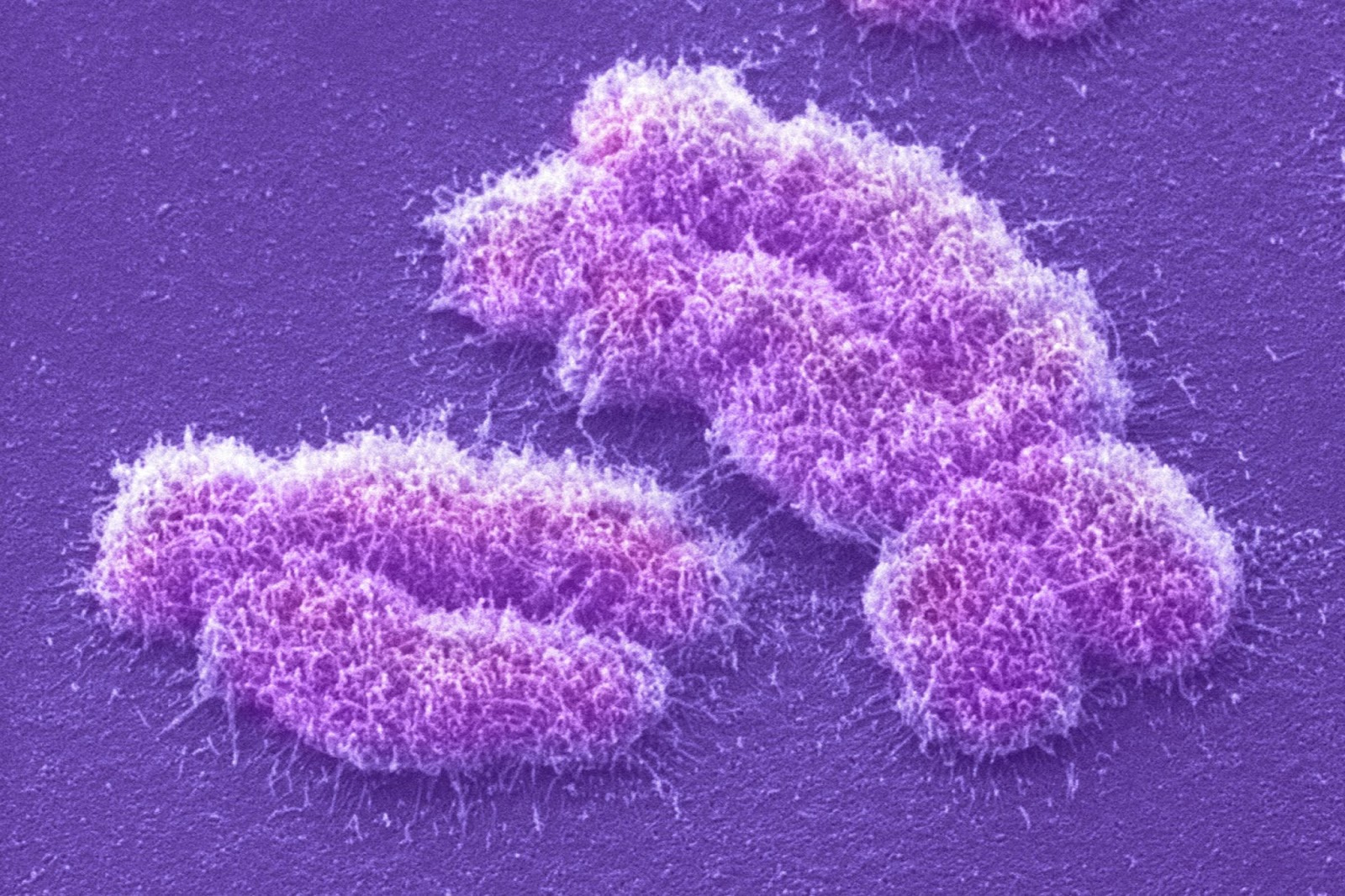 Chromosom X - właściwie zinterpretowany - jest ogromną pomocą ...