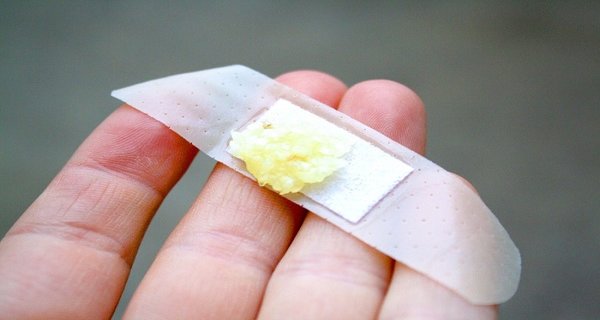 Remove A Wart Naturally - Using Garlic Remove A Wart Naturally Using Garlic
