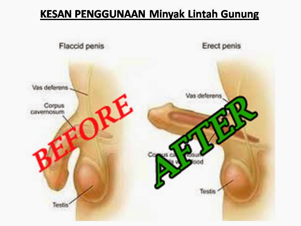 Gambir Sarawak Asli Minyak Lintah Gunung