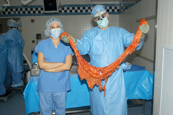 No Colon