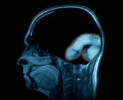 IRM_cerveau_dsk.gif