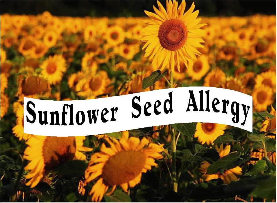 Free Posters and Signs Sunflower Allergy