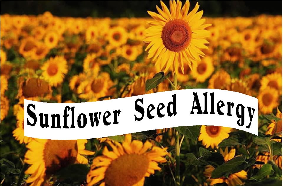 Free Posters and Signs Sunflower Allergy