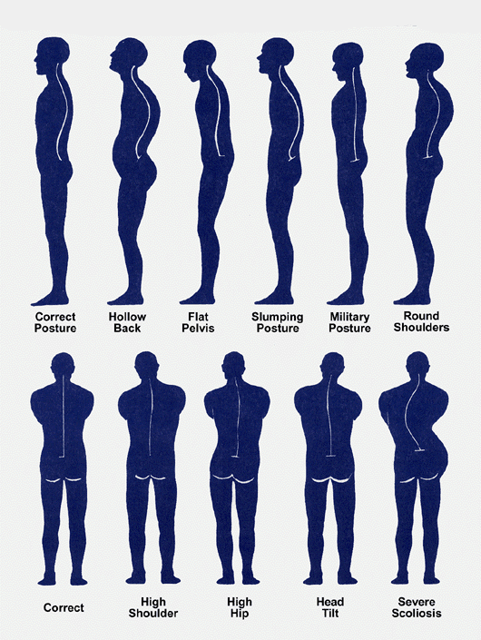 Lower Back Pain Right Side