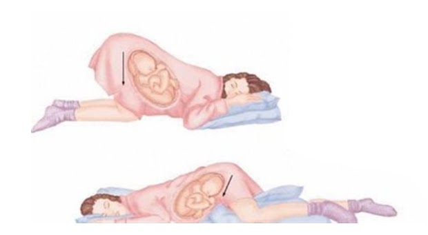 Tips Of Life The Proper Sleeping Position During Pregnance
