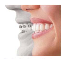 San Jose dentist