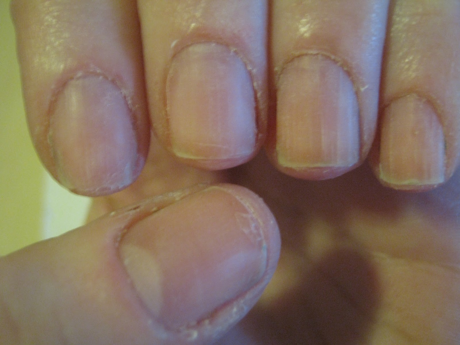 Rehab Your Nails Basic Manicure Bee Polished