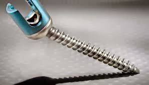 Proliant www.thespinemarketgroup.com