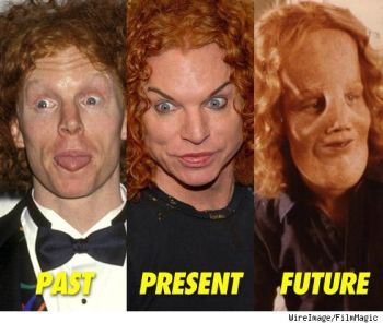 Carrot   Plastic Surgery on Daily Me  Carrot Top