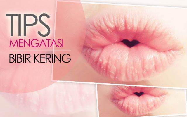 Tips Sembuhkan Bibir Kering dan Pecah Pecah