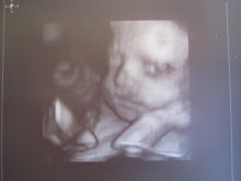 Berkley's 28 Week 3D Ultrasound