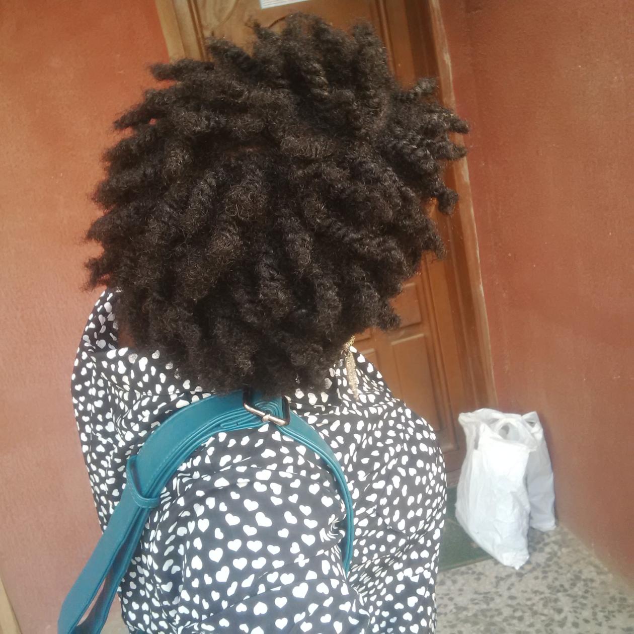 African Naturalistas 3 Ways To Get Rid Of Itchy Scalp On Natural Hair