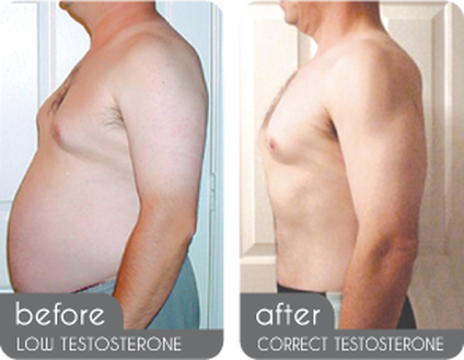 Testosterone for men over 50