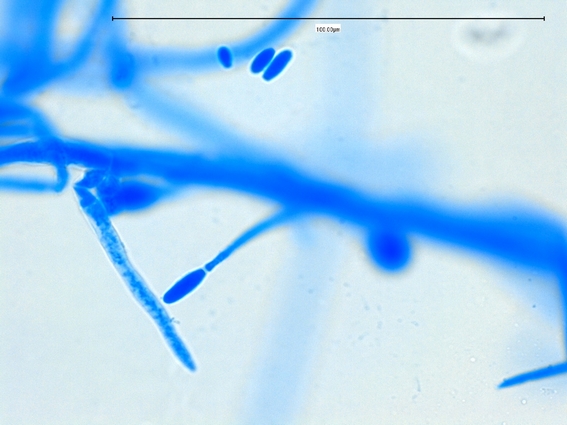 Fun With Microbiology ...