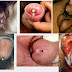 Antibiotik Alami Untuk Penyakit Kencing Nanah thumbnail