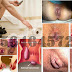 Harga Promo Obat Wasir (Hemoroid) AmbeJOSS thumbnail