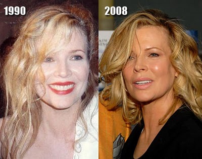 Nadya Basinger