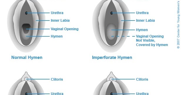 The Virgin Diaries: Whats up with my hymen?!?! The Virgin Diaries: Whats up with my hymen?!?!