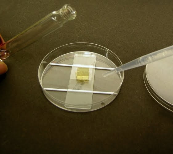 Fun With Microbiology (What's Buggin' You?) Slide Culture Technique