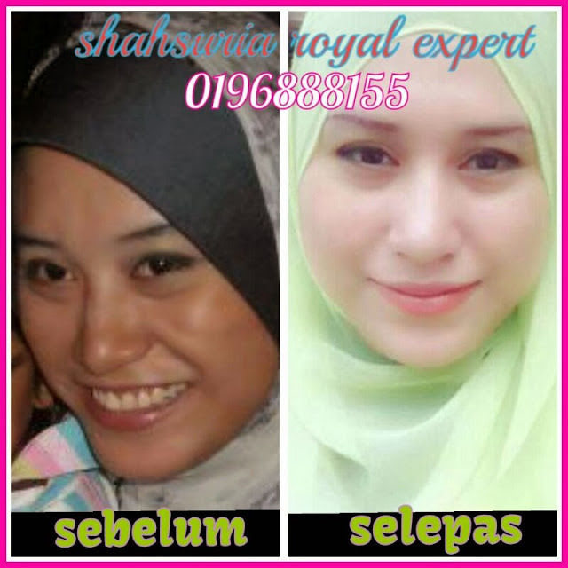 Promosi Royal Expert White Malaysia Original Royal Expert White Testimoni 15