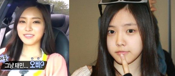 i don't mind ppl getting plastic surgery but i think naeun had fillers...