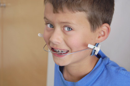 Rubber Band Teeth