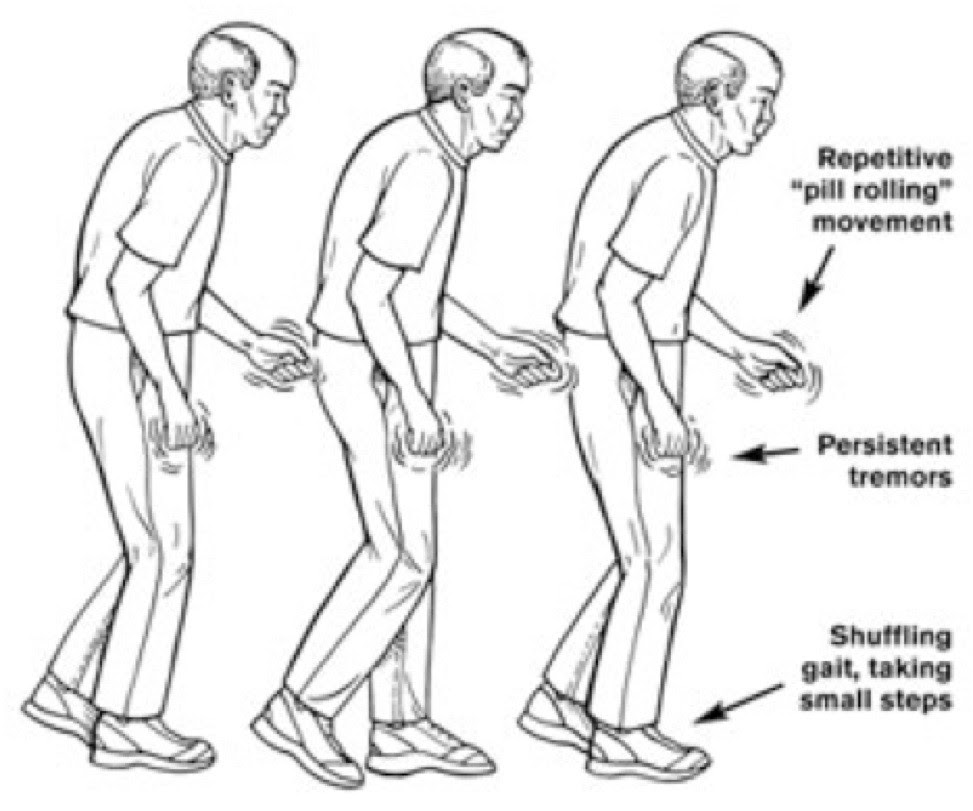 Medical Health Treatment and Therapy Clinical Manifestations of