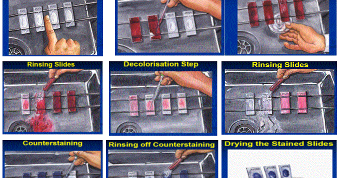 Gudangbaca Pewarnaan Ziehl Neelsen