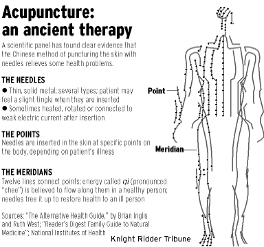 Acupuncture Updates!