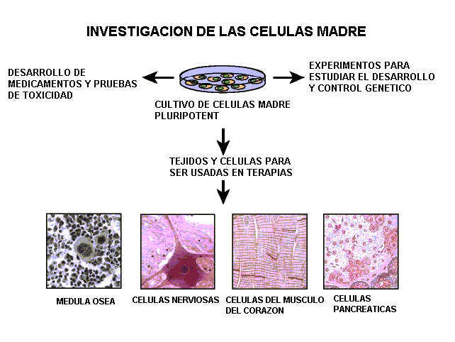 Eventos Cerebro Vasculares: Células madre para el Eventos Cerebro Vasculares: Células madre para el