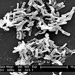 Photomicrograph credit: CDC/Louis S. Wiggs/Wikipedia