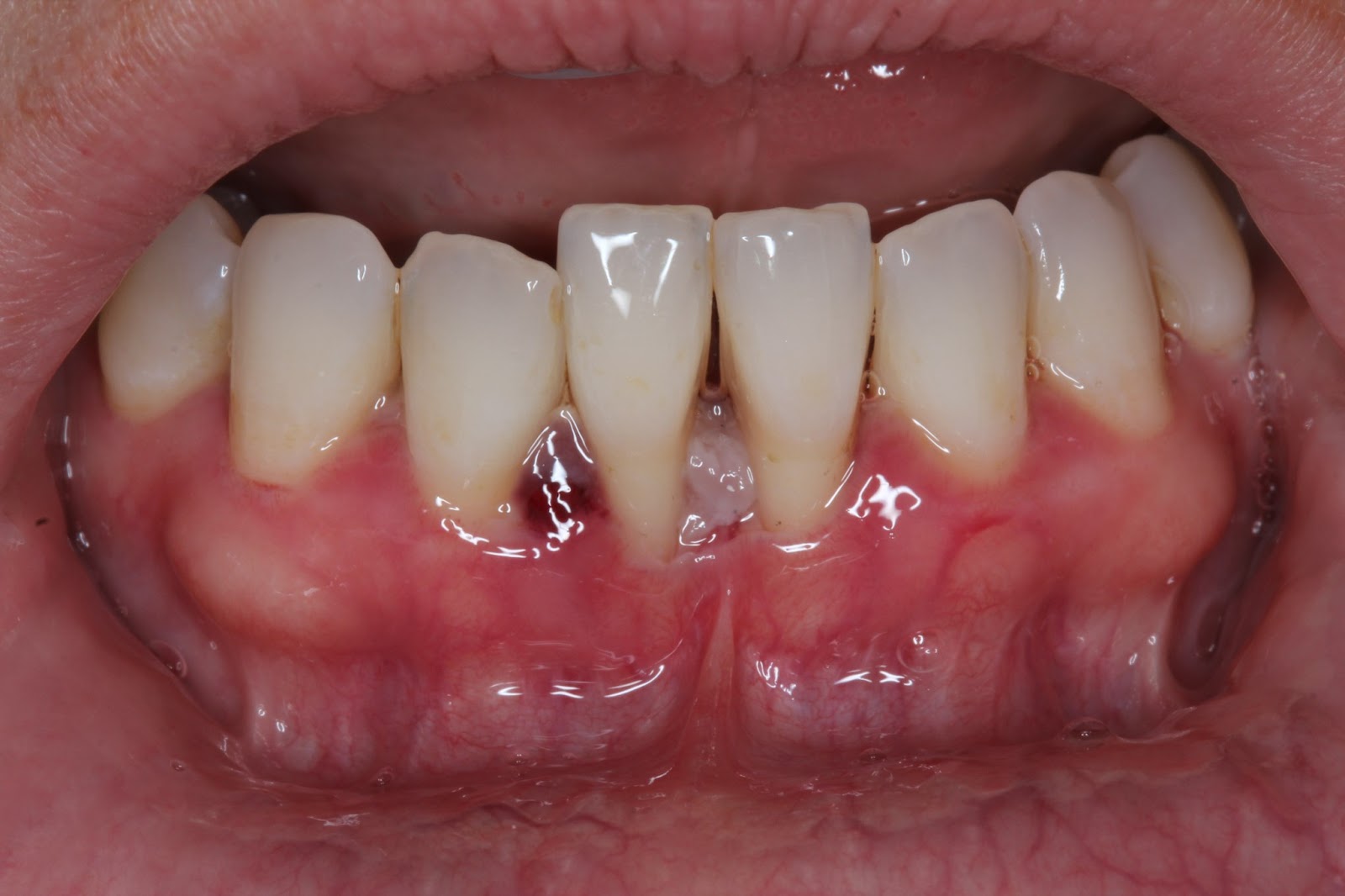 San Clemente Dentist Radiant Smiles Dental Care Laser and Cosmetic