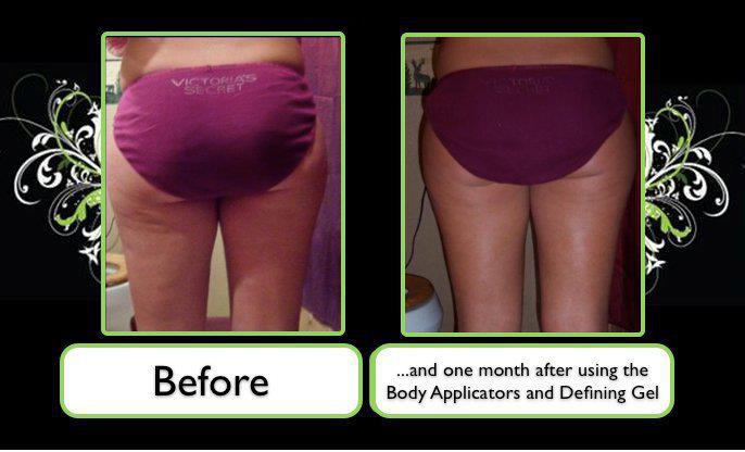 thats a wrap cellulite treatments do they really work it works really work
