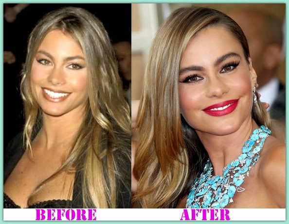 Sofia Vergara Nose Job Plastic Surgery Before After.