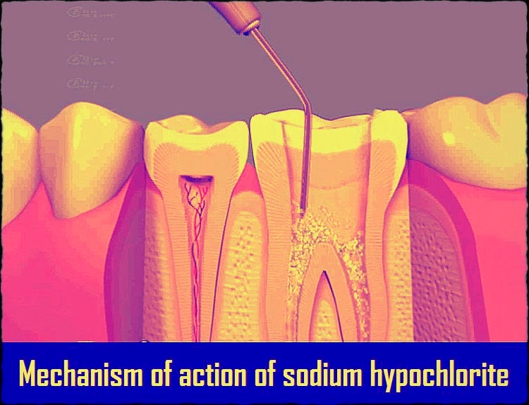 PDF Mechanism of action of SODIUM HYPOCHLORITE Odontología Virtual