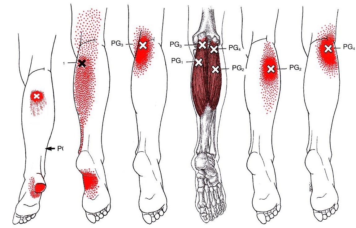 La osteocondrosis en los pies