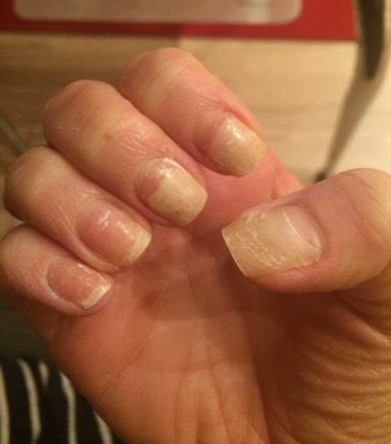 Secret Diary of a Chemo Girl Nailed it