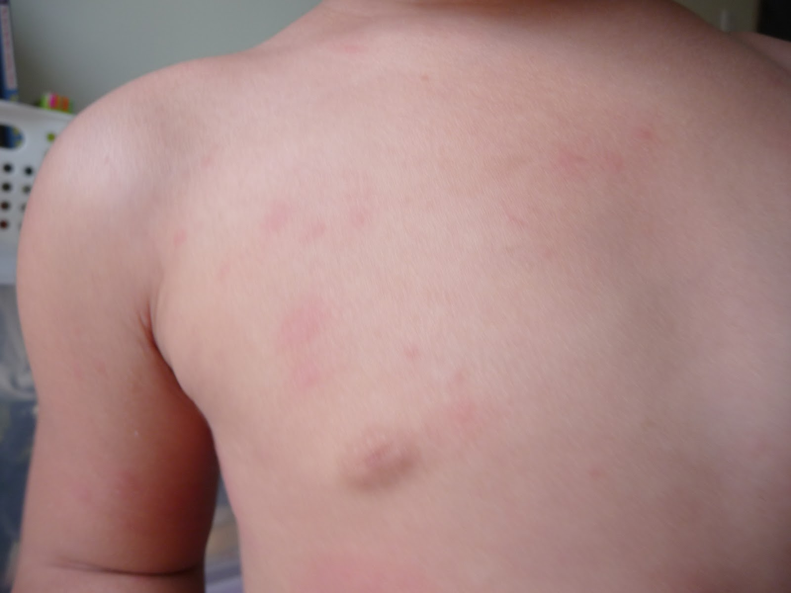 Epicurean Mommy Allergy Indoor Plants Remedy