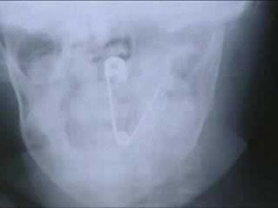 Some Weird And Bizarre X-RAY Pictures