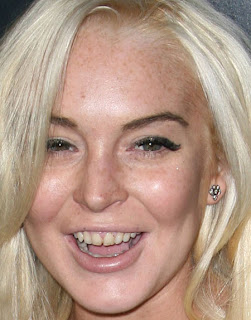 Lindsay Lohan Teeth