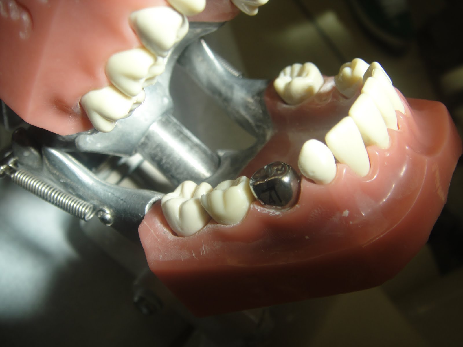 StuDENT Diaries Pedo Stainless Steel Crown